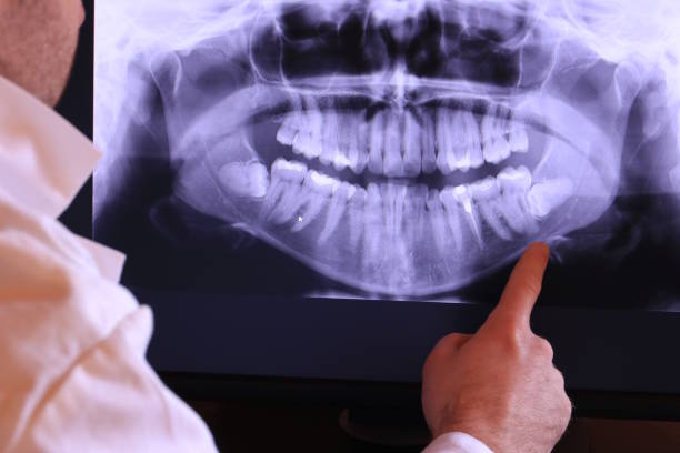 Best Emergency Gum Pain Relief  in Mante, CA