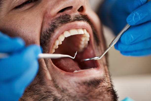 Best Dentist Open on Weekends  in Mante, CA